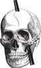 phineasgage-small.jpg